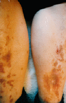 {short description of image}